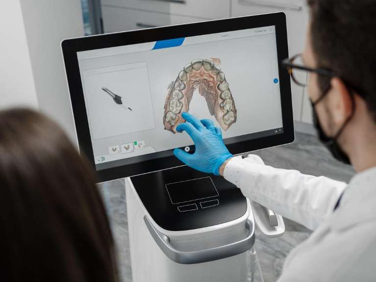 screen with digital impressions of treatment | lifelong dental clinic